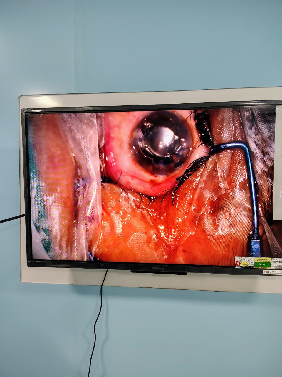 Ophthalmology at K.K. Medical College